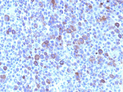 IHC -  Glypican-3 (GPC3) (Hepatocellular Carcinoma Marker) Antibody - With BSA and Azide AH11317-20